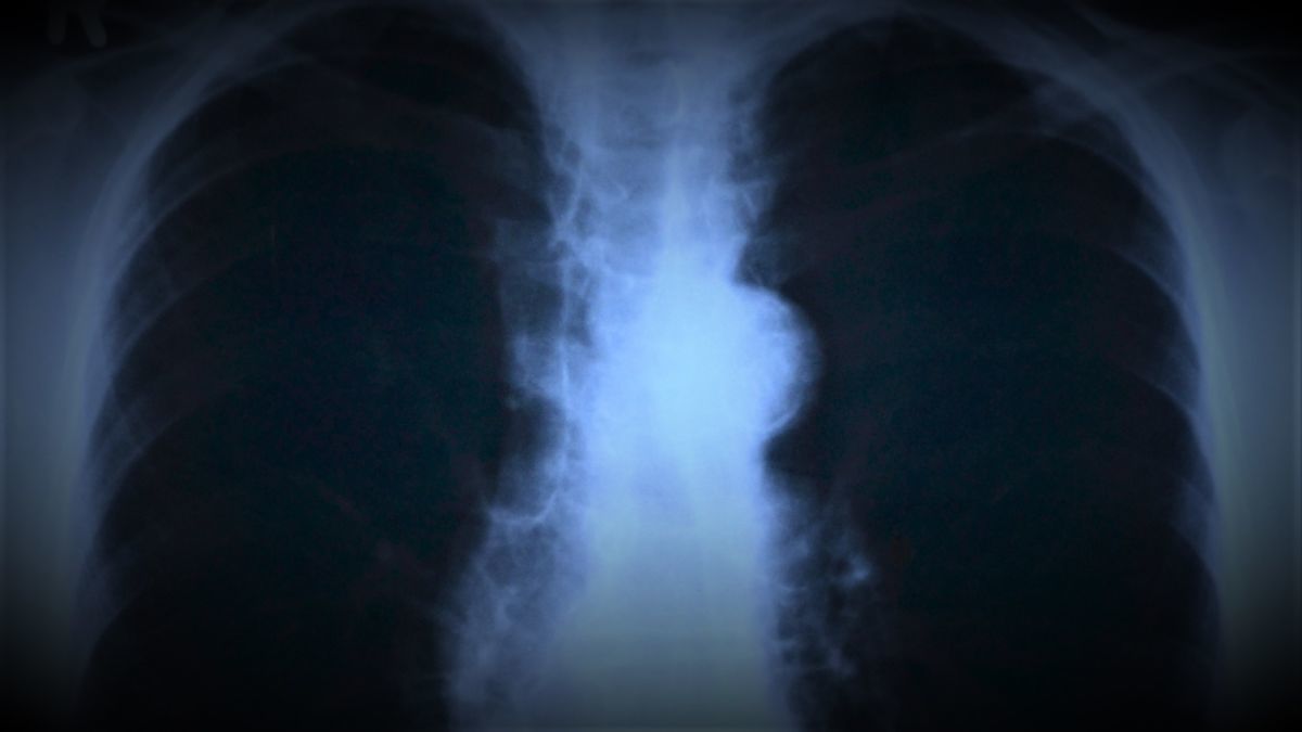 Pandemia, ca o radiografie